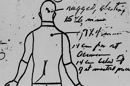 Kennedy_Autopsy_Sketch